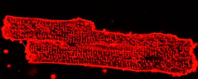 T-tubule network — ANEPPS staining, 40×