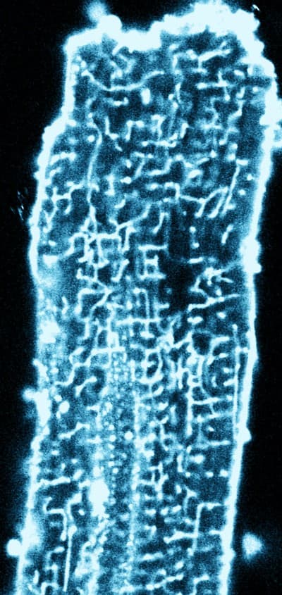 T-Tubulus-Netzwerk eines Kardiomyozyten, ANEPPS-Membranfärbung, 40-fach, Ausschnitt