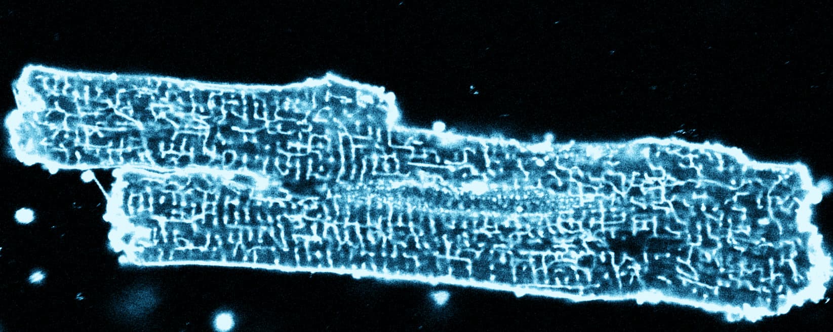 T-Tubulus-Netzwerk von Kardiomyozyten, ANEPPS-Membranfärbung, 40-fach
